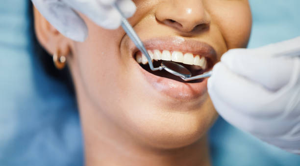 Best Emergency Root Canal Treatment in Dranesville, VA