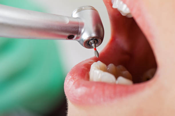 Best Urgent Dental Care for Toothache in Dranesville, VA